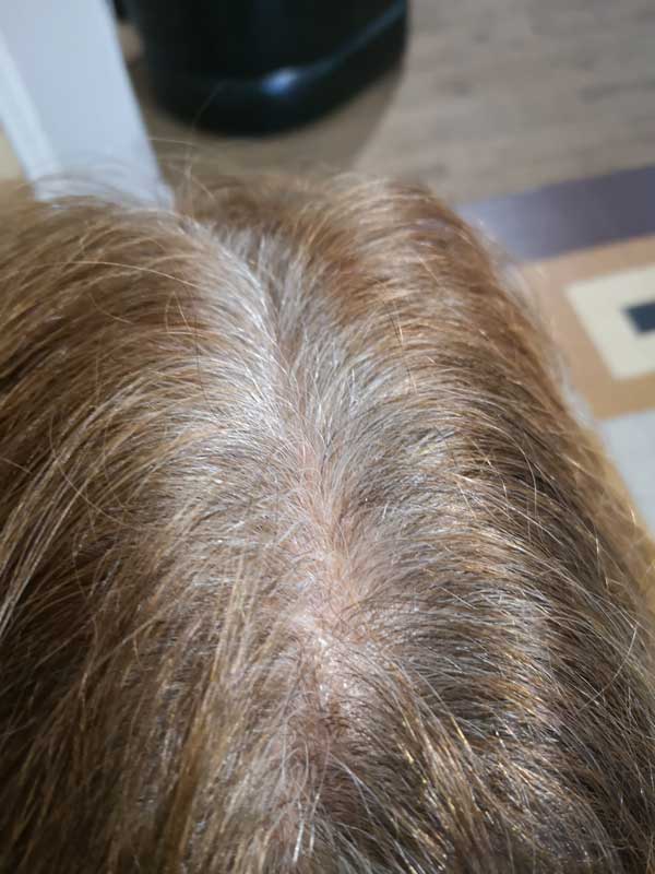 photo avant coloration 