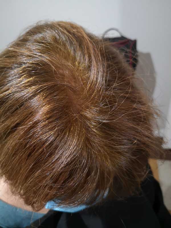 photo après coloration marcapar